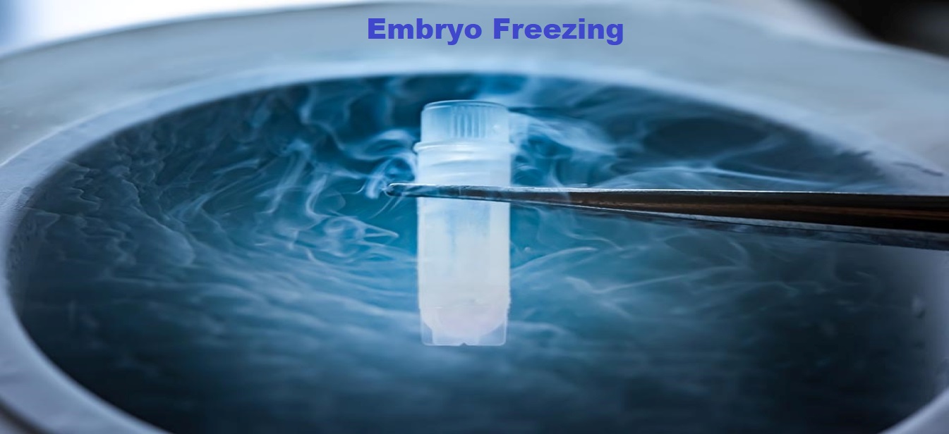 Embroy image